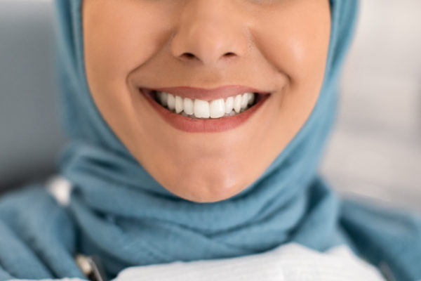 The-best-at-home-teeth-whitening-products