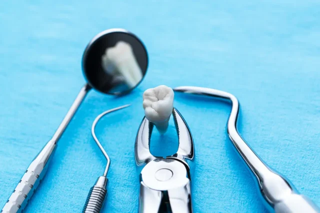 care-during-teeth-removal