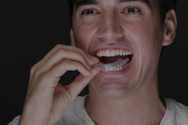 invisalign