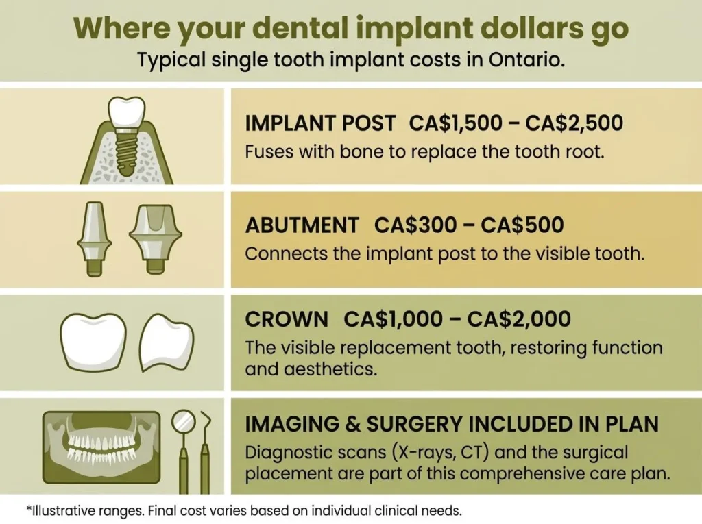 Dental Implants Cost in London Ontario