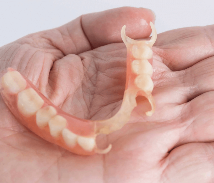 Acrylic-Partial-Dentures-O