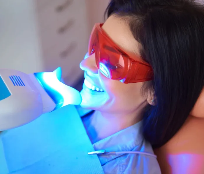 Professional-Teeth-Whitening